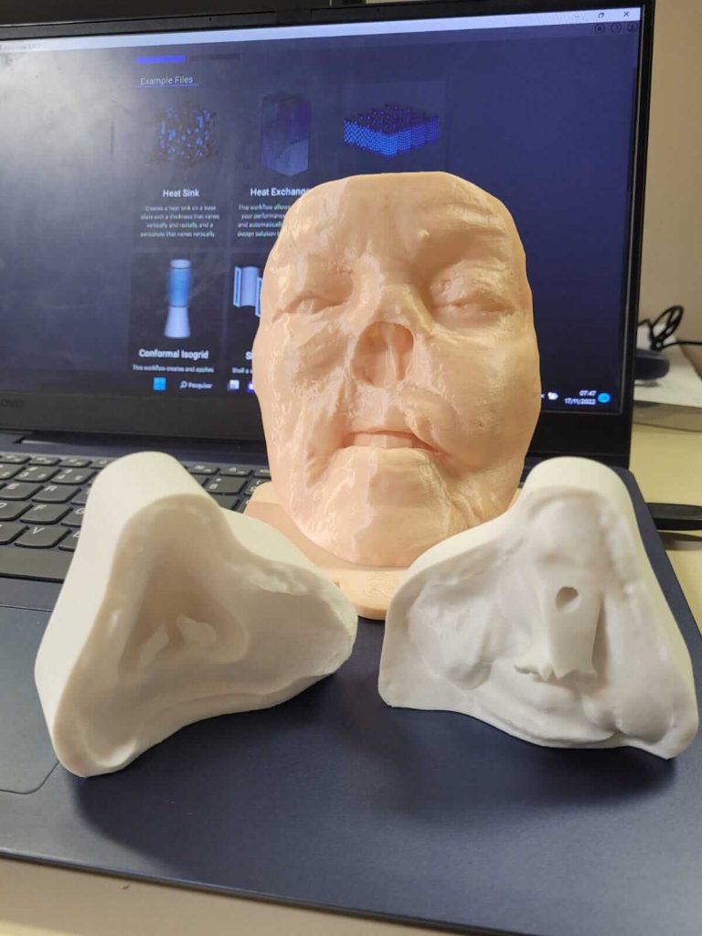 Molde para prótese facial fabricado por impressão 3D